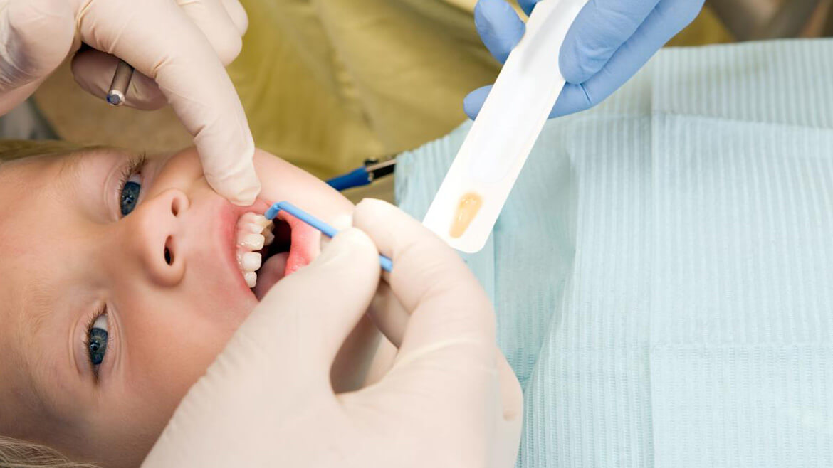 Fluoride Treatments for Children