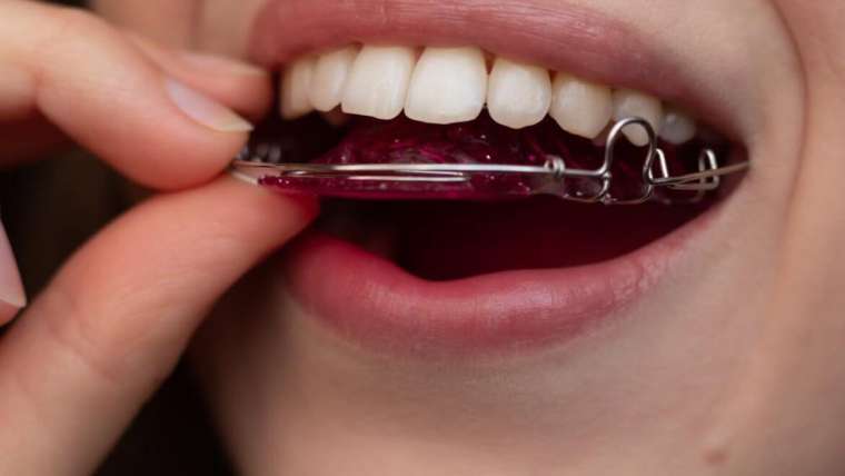 Retainers